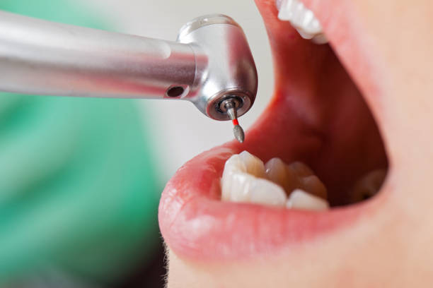 Best Urgent Care for Lost Fillings or Crowns in Ely, MN